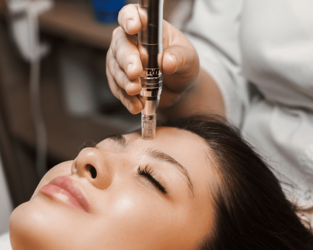 Microneedling Treatment in Naples, Florida | The Wellness Lab