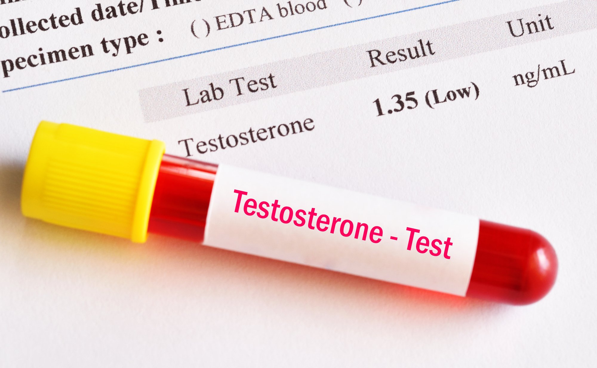 what-are-the-different-types-of-testosterone-the-wellness-lab