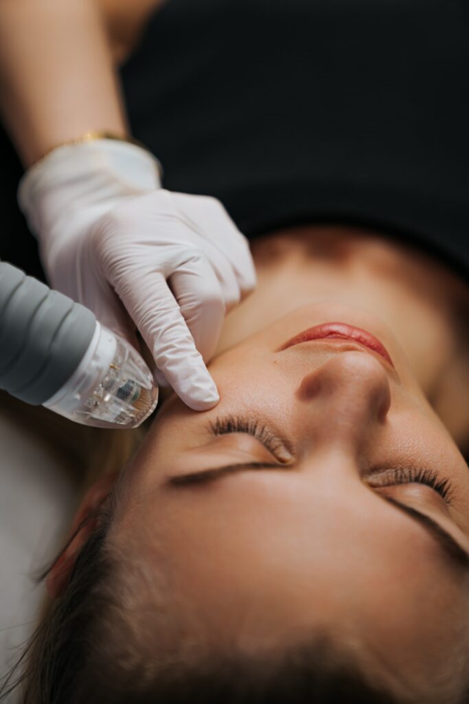 Skin Pen Microneedling | Fort Myers