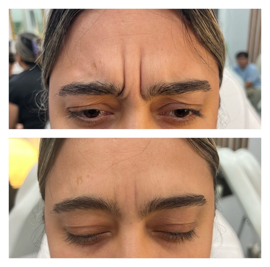 botox naples fl