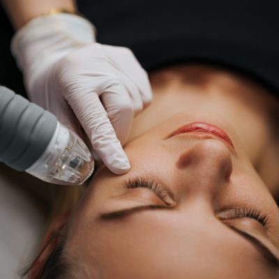 Skin Pen Microneedling | Fort Myers